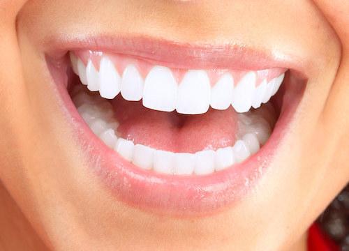 Close up of bright smile l Family Dentistry of Royal Oak Royal Oak MI