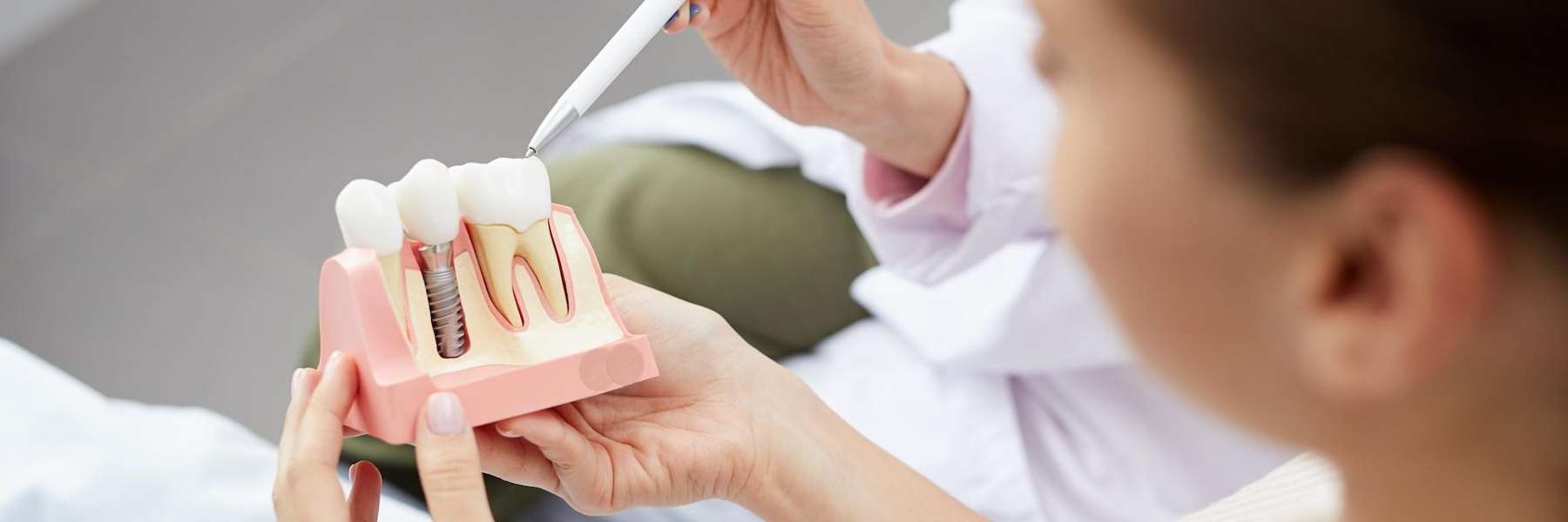An illustration of dental implants in Royal Oak, MI