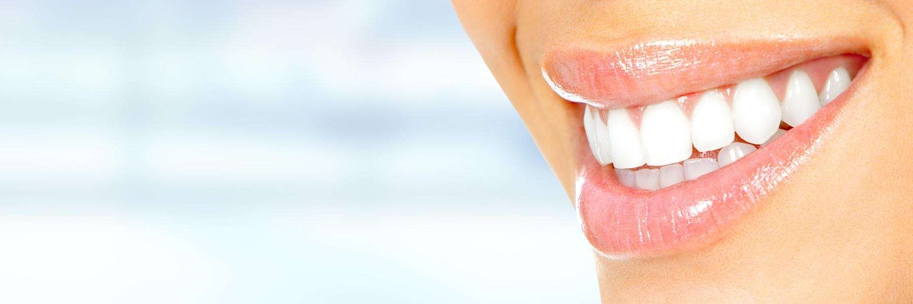 A patient smiling after getting Veneers in Royal Oak, MI
